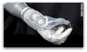 DEKA Prosthetic Arm named Luke inspired by Star Wars